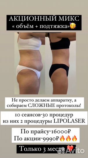 Массаж коррекция фигуры