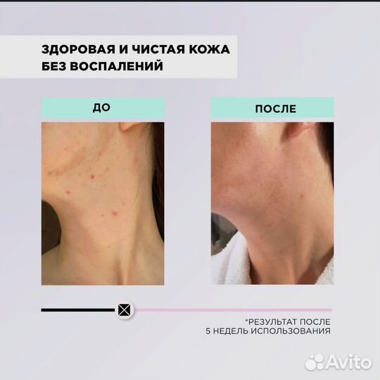 Сыворотка mixit для улучшения состояния кожи лица