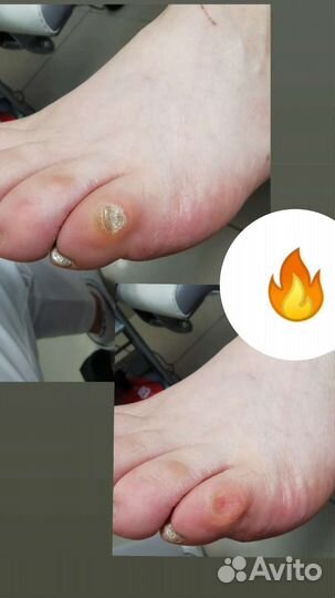 Услуги подолога