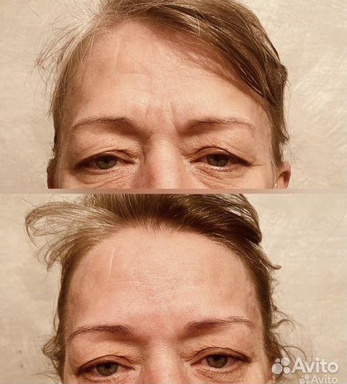 Массаж лица и тела