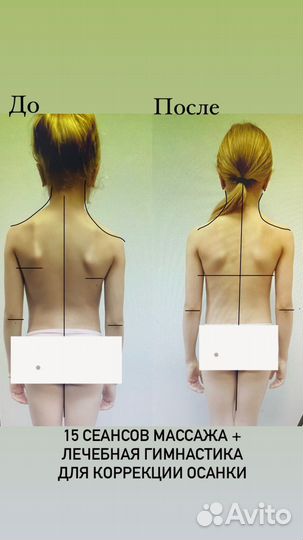 Детский массаж на дому/коррекция осанки