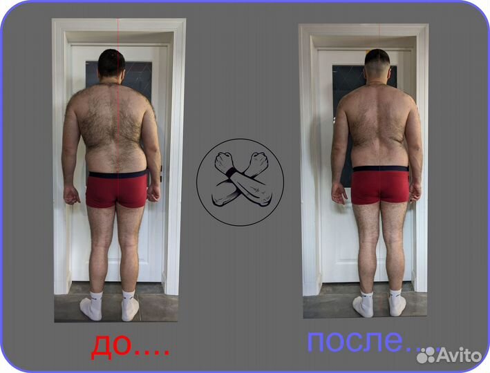 Миотерапия, лечение хронической боли, выезд на дом
