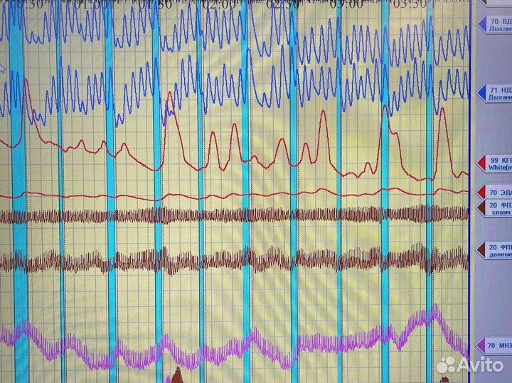 Проверка на полиграфе. Детектор лжи