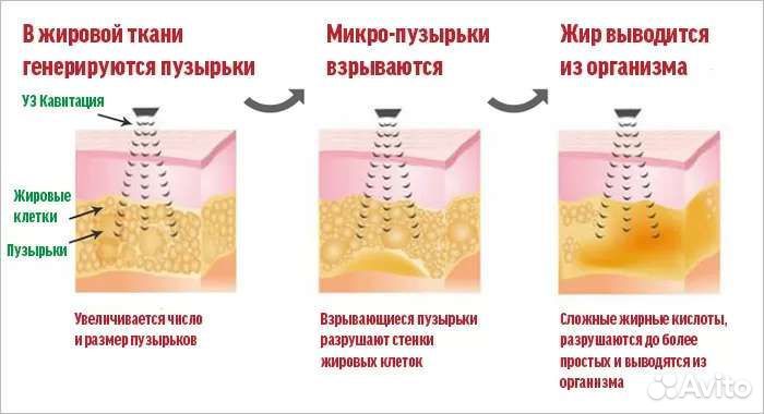 Аппарат 5в1 kim 8 RF лифтинг кавитация