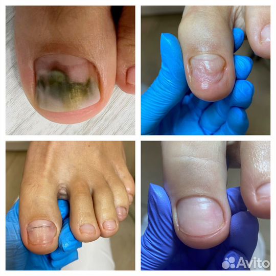 Услуги подолога