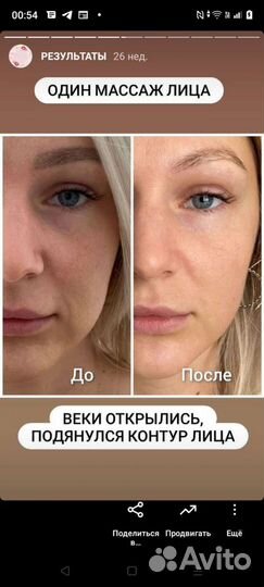 Массаж оздоровительный