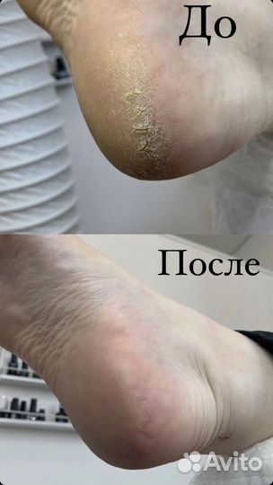 Маникюр и педикюр в 4 руки