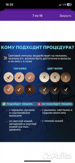 Фотоэпилятор