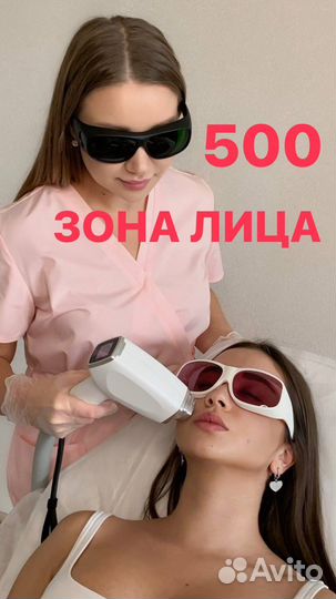 Лазерная эпиляция