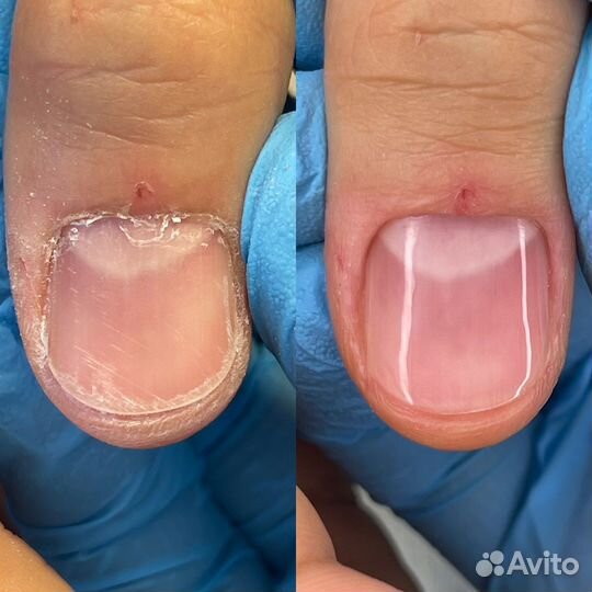 Мужской маникюр и педикюр