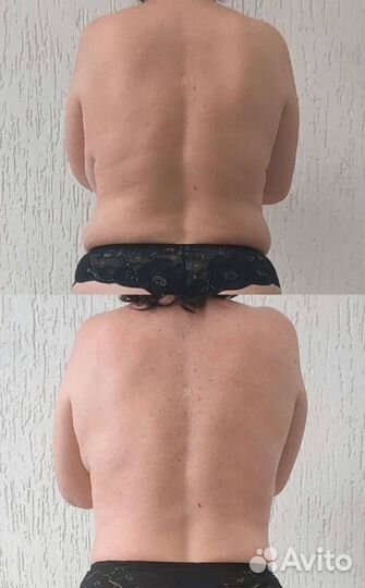 Аппаратный массаж (курс фигура песочные часы)