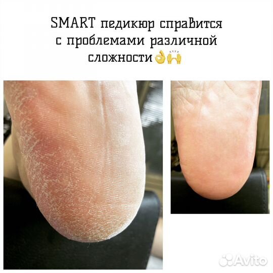 SMART педикюр, маникюр Абакан
