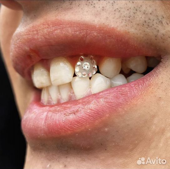 Установка Скайс