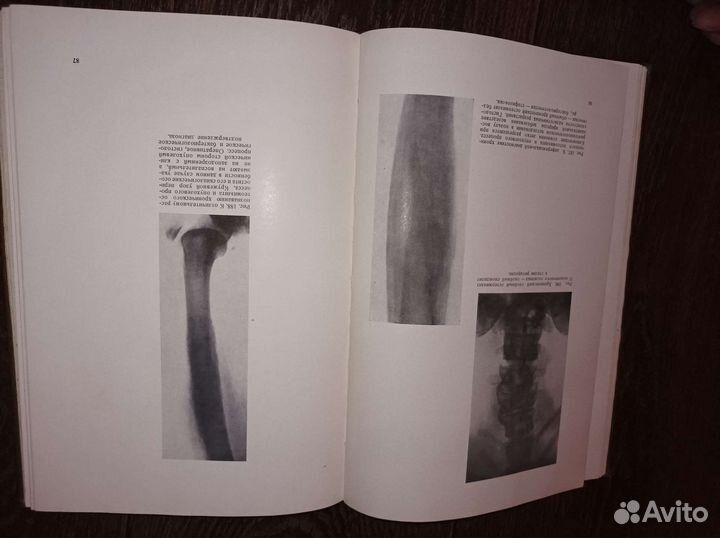 Медицинские старые книги