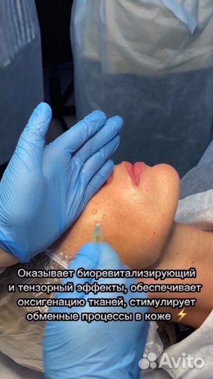Итальянский пилинг