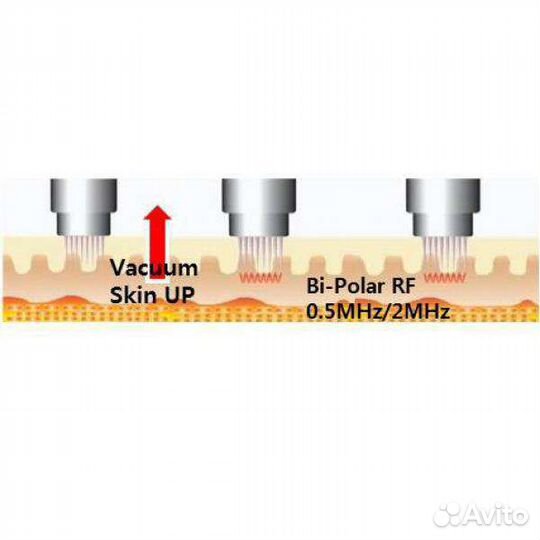 Микроигольчатый аппарат RF Inus Оригинал