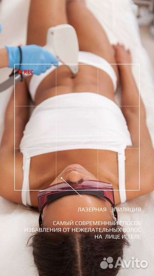Диодная эпиляция