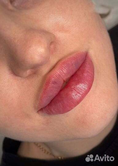 Вкусные губы корекция увеличение пластика губ