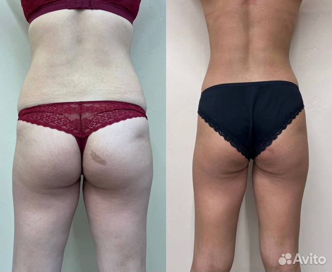 R-sleek, авторский курс массажа