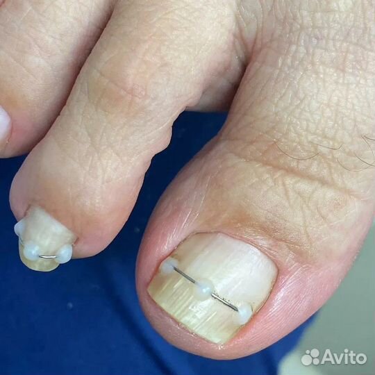 Подолог в центре