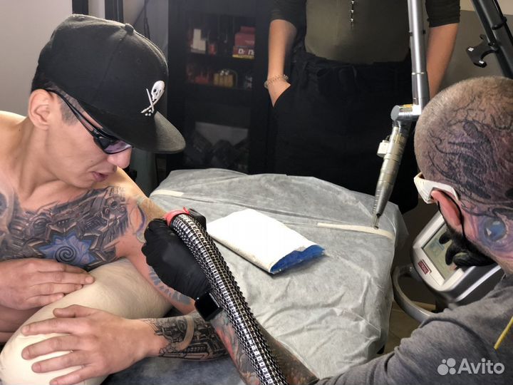 Удаление тату в клинике