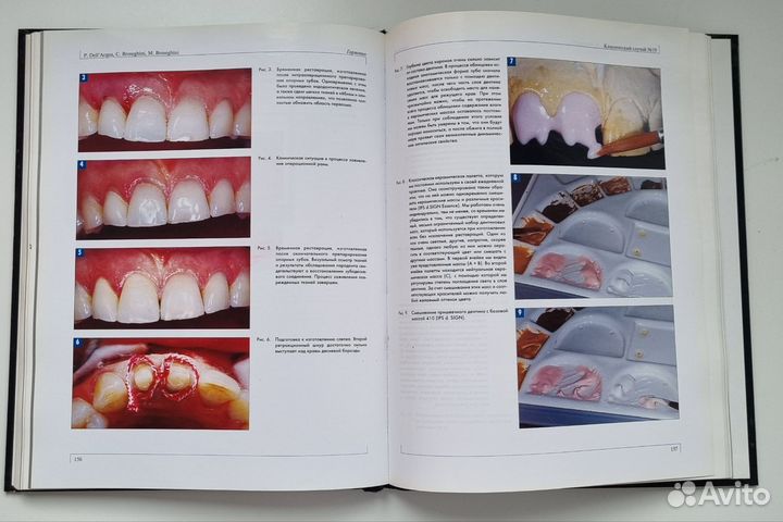 Книга по стоматологии. 30 случаев из практики