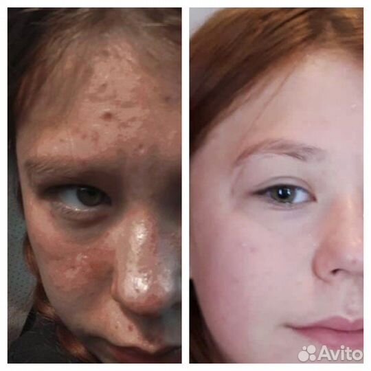 Полный гид по питанию для похудения и здоровья