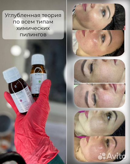 Обучение на косметолога