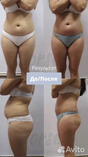 Массаж для похудения