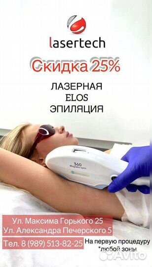 Лазерная эпиляция