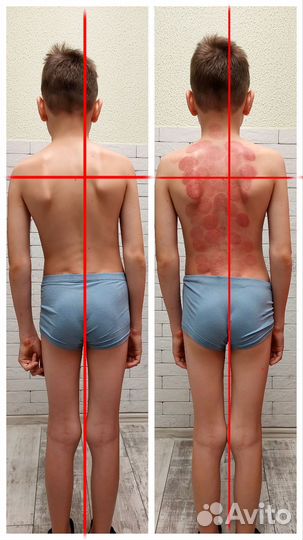 Массаж Лечебный