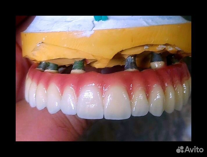 Зубной техник