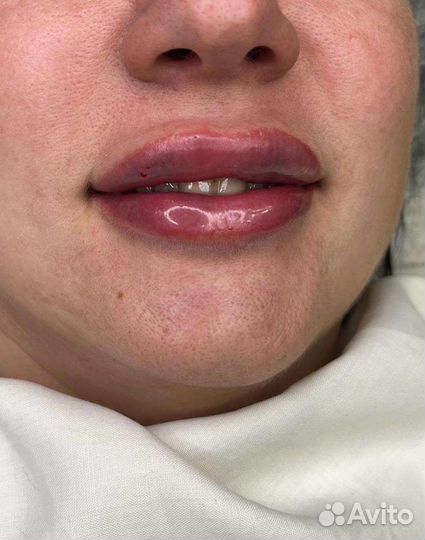 Услуги косметолога