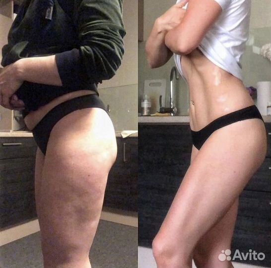 Антицеллюлитный массаж, массаж лица. Эффект сразу