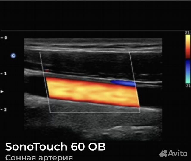 Аппарат Узи Sonotouch 60
