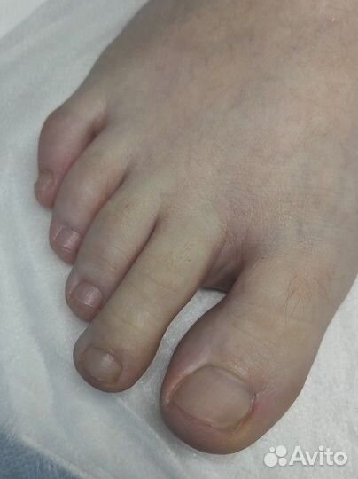 Услуги подолога