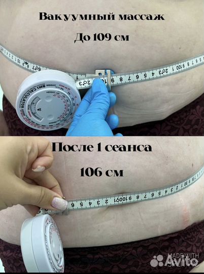 Массаж коррекция фигуры