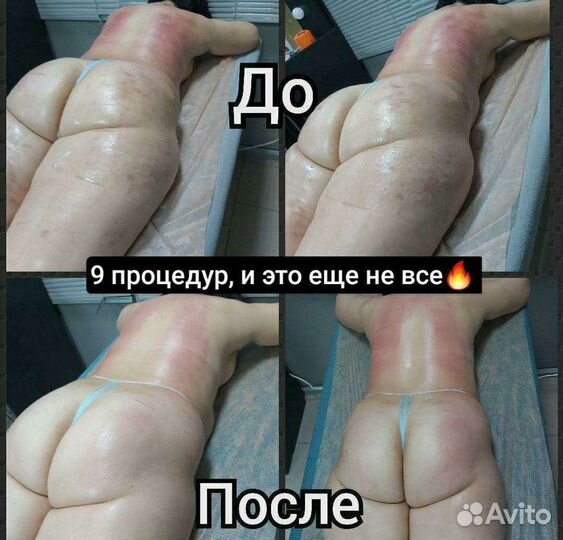 Коррекция фигуры