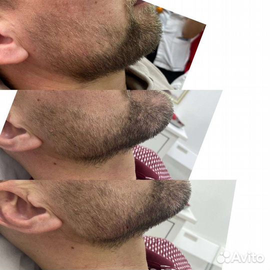 Приглашаю моделей