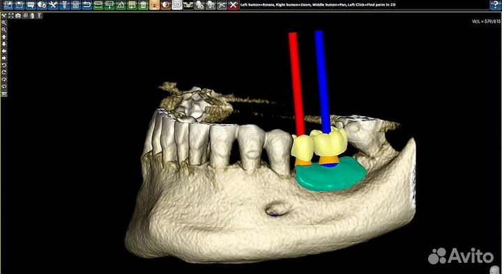 3Diagnosys + Plastycad