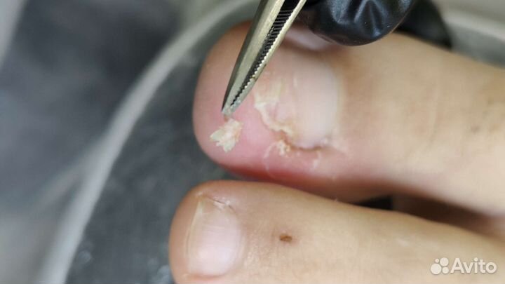 Подолог / мастер маникюра и педикюра