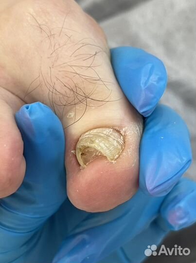 Подолог педикюр маникюр (пилочный) покрытие