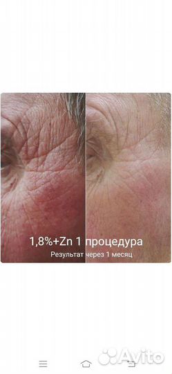 Full face (лицо под ключ) Ступино Московия