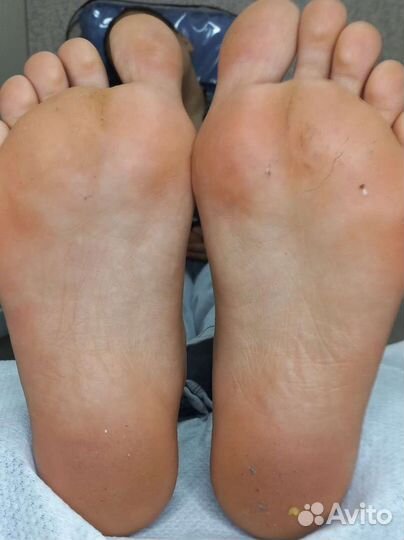 Смарт педикюр