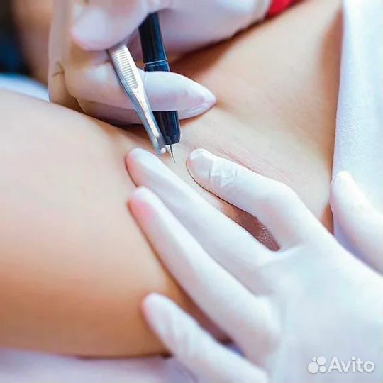 Курс «Электроэпиляция»