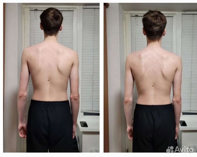 Омолаживающий массаж лица. Коррекция осанки,массаж