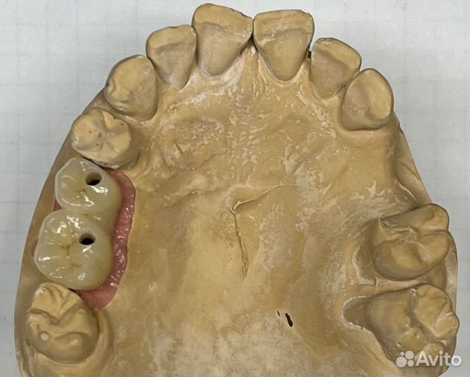 Зубной техник
