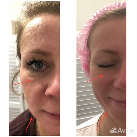 Коррекция фигуры и лифтинг лица