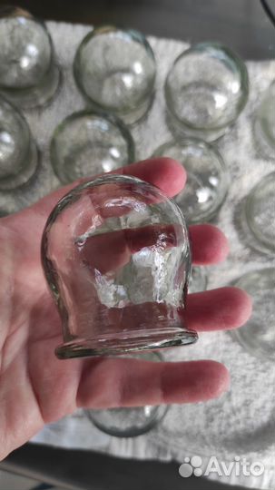 Медицинские вакуумные банки СССР цена за все