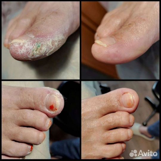 Маникюр/Подолог эстетист